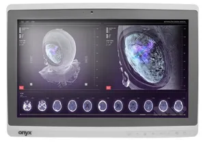Onyx-Zeus-248 PC AiO i7-7600U 8-250GB SSD 24" Touch W10P 1YW #RFB Medical